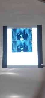 den doc film xquang led gia re.jpg