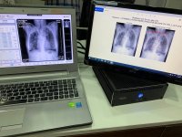 xe chup xquang luu dong (2).jpg