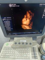 may sieu am thanh ly (3).jpg