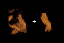 may sieu am 4D Siui Apogee 3300 (2).jpg