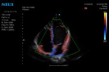 may sieu am 4D Siui Apogee 3300 (4).jpg